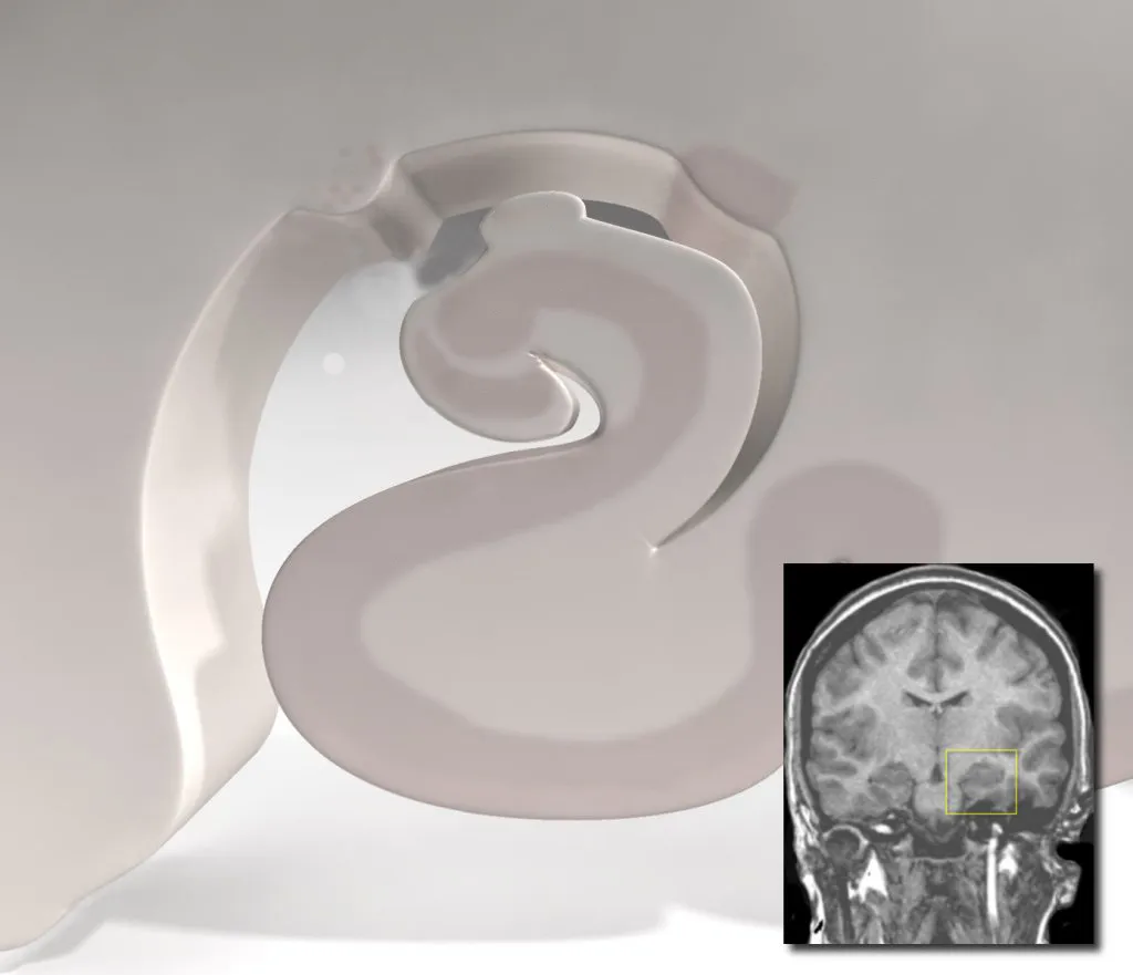 Your Brain Might Still Be Listening While You're Knocked Out