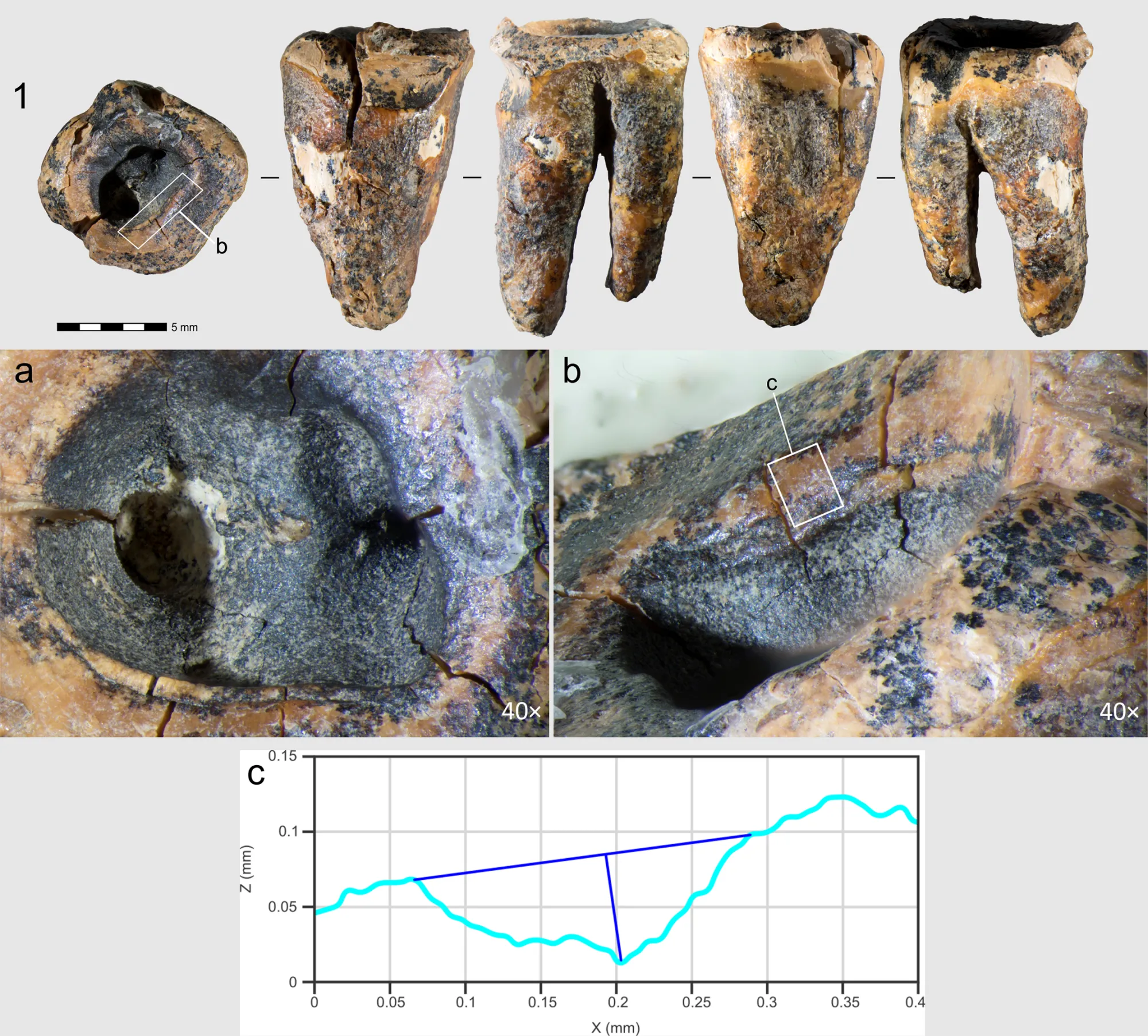 Neanderthals Were Doing Dental Surgery 59,000 Years Ago, and the Evidence Is Literally in One Tooth