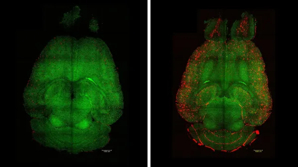 A Single Shot Cleared Alzheimer's From a Mouse Brain in One Hour. It Was Not Even a Drug.